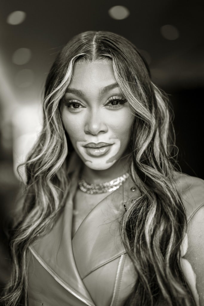 Canadian model Winnie Harlow poses for a photo in the Paepcke Auditorium after a panel discussion at the Aspen Ideas Festival 2022.